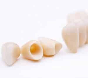 dental-crowns-and-dental-bridges