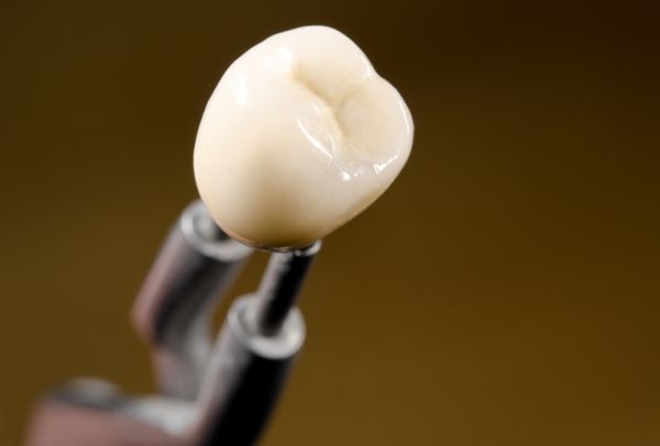 Dental Crowns and Bridges