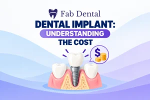 Dental Implant Understanding The Cost