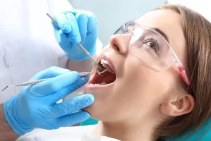 Procedimiento de conducto radicular, Dentistas de emergencia, Odontología de emergencia para extracción de dientes