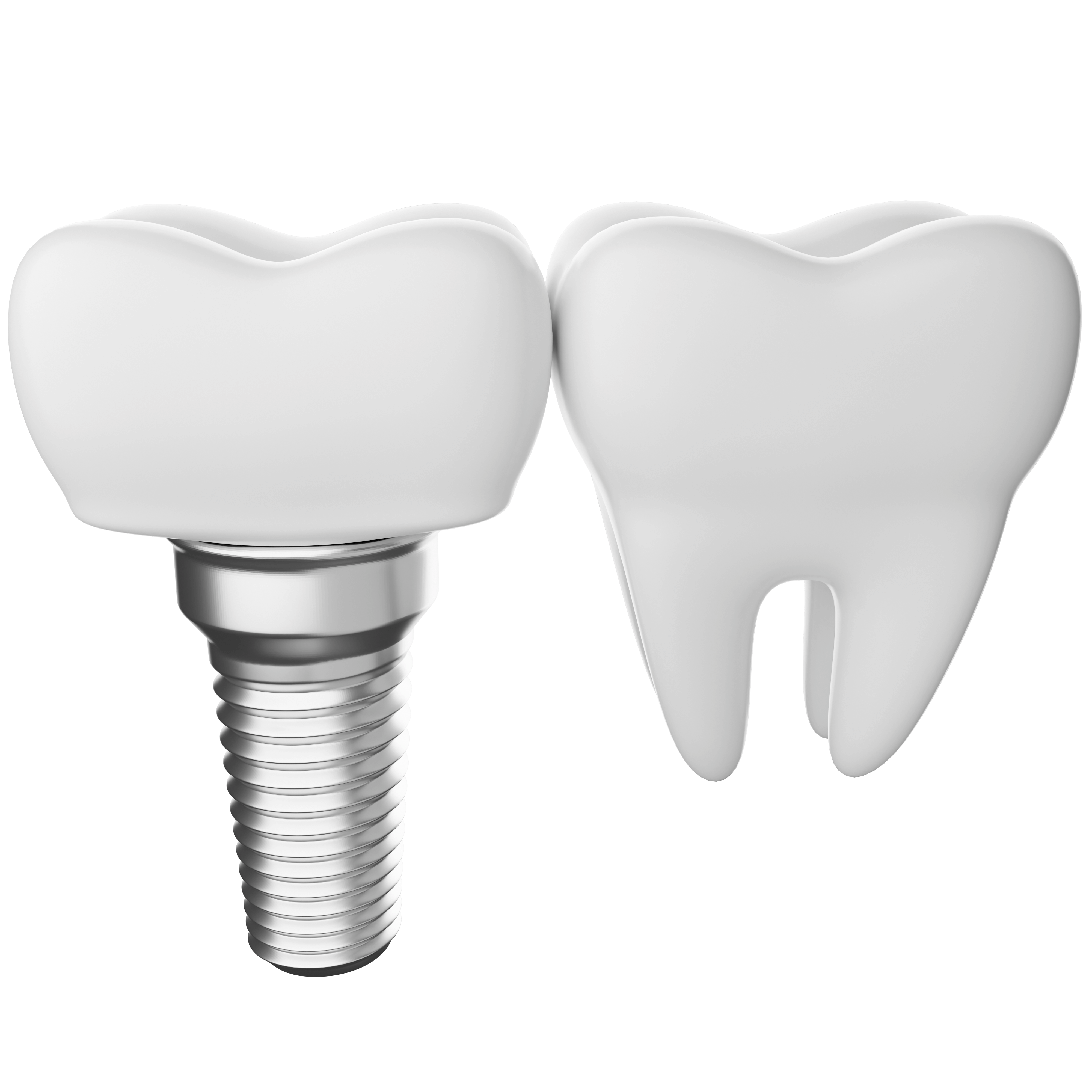 implantes dentales