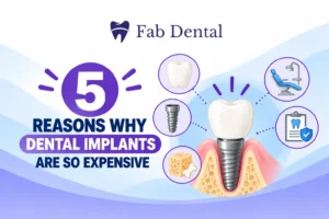 5 Reasons Why Dental Implants Are So Expensive