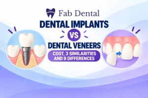 Dental Implants vs Dental Veneers Cost, 3 Similarities and 9 Differences