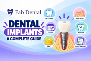 Dental Implants - A Complete Guide