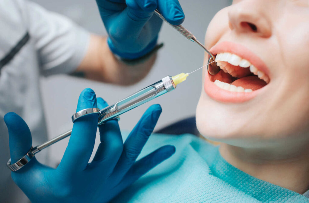 How Long Does Numbing Last After Root Canal?