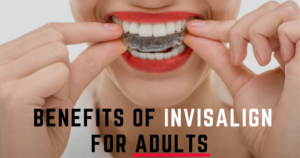 بالغوں کے لیے Invisalign