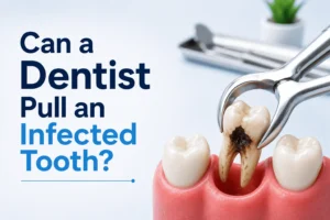 Maaari bang bunutin ng Dentista ang isang Impeksyon ng Ngipin