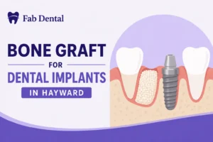 Blog Bone Graft for Dental Implants
