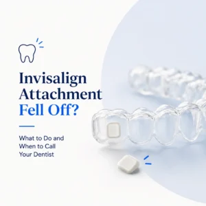 Nahulog ang Kalakip ng Invisalign