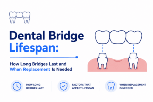 Blog Dental Bridge Lifespan