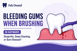 Bleeding Gums