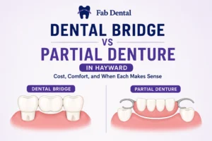 Blog Dental Bridge vs Partial Denture