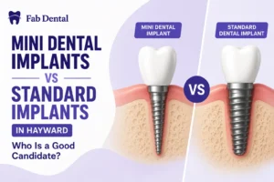 Blog Mini Dental Implants vs Standard Implants