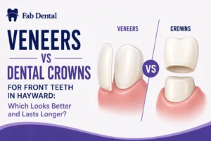 Blog Veneers vs Dental Crowns