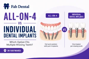 Blog All-on-4 vs Individual Dental Implants
