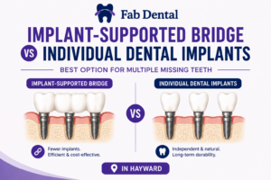 Blog Implant-Supported Bridge vs Individual Dental Implants in Hayward: Best Option for Multiple Missing Teeth