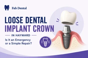 Blog Loose Dental Implant Crown