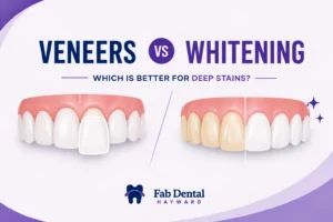 Blog Porcelain Veneers vs Teeth Whitening