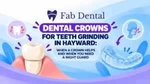 Blog Dental Crowns for Teeth Grinding