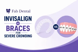 Blog Invisalign vs Braces for Severe Crowding