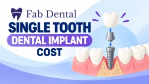 Blog Single Tooth Dental Implant Cost