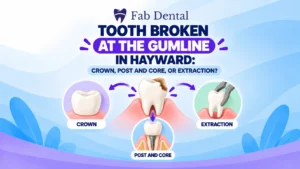 Blog Tooth Broken at the Gumline