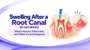 Swelling After a Root Canal